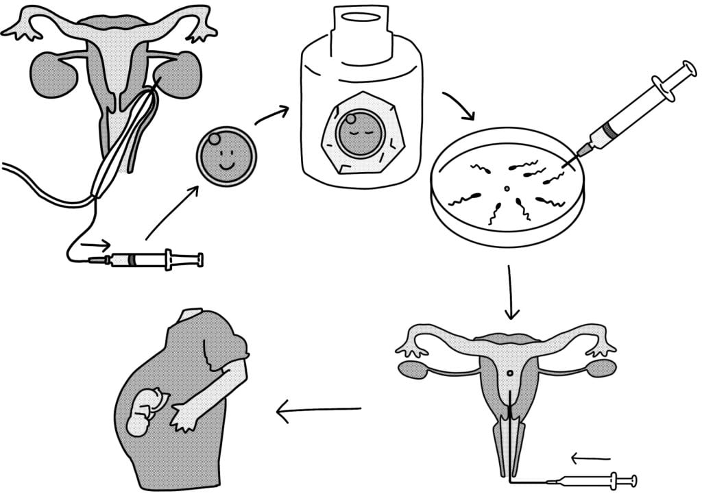 体外受精しても採卵数が少なく妊娠率低下